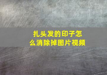 扎头发的印子怎么消除掉图片视频