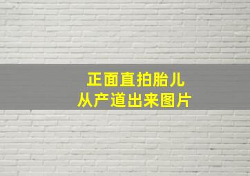 正面直拍胎儿从产道出来图片