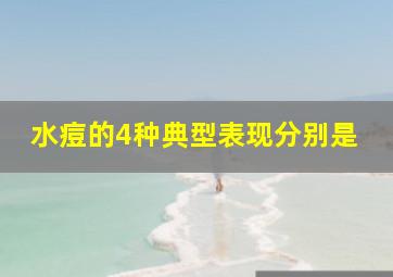 水痘的4种典型表现分别是