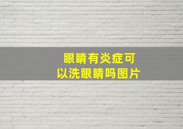 眼睛有炎症可以洗眼睛吗图片