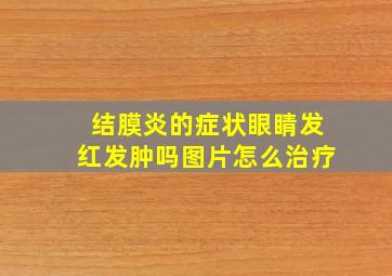 结膜炎的症状眼睛发红发肿吗图片怎么治疗