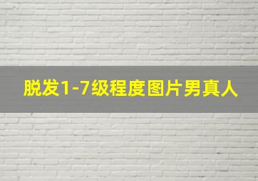 脱发1-7级程度图片男真人