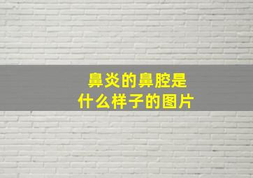 鼻炎的鼻腔是什么样子的图片