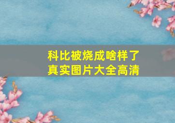 科比被烧成啥样了真实图片大全高清